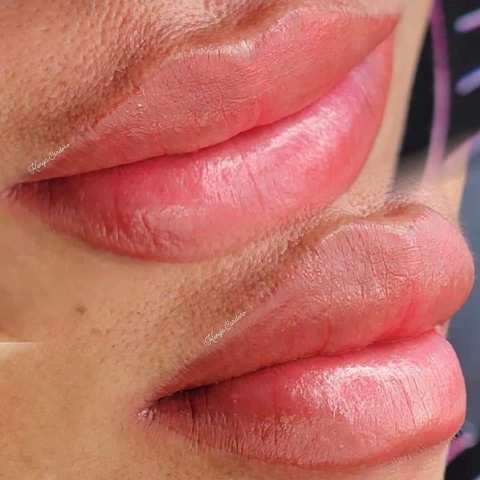 lip 4